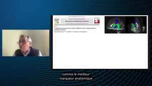 ANDREW2 (Autism and NeuroDevelopment REsearch Workshop 2) - « From dyslexia to autism: towards a unifying common model of altered brain connectivity in neurodevelopmental disorders » - Michel Habib - Version Sous-titrée