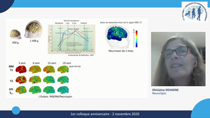 1er colloque anniversaire GIS Autisme et TND / Ghislaine DEHAENE / Neuro-Développement et apprentissages
